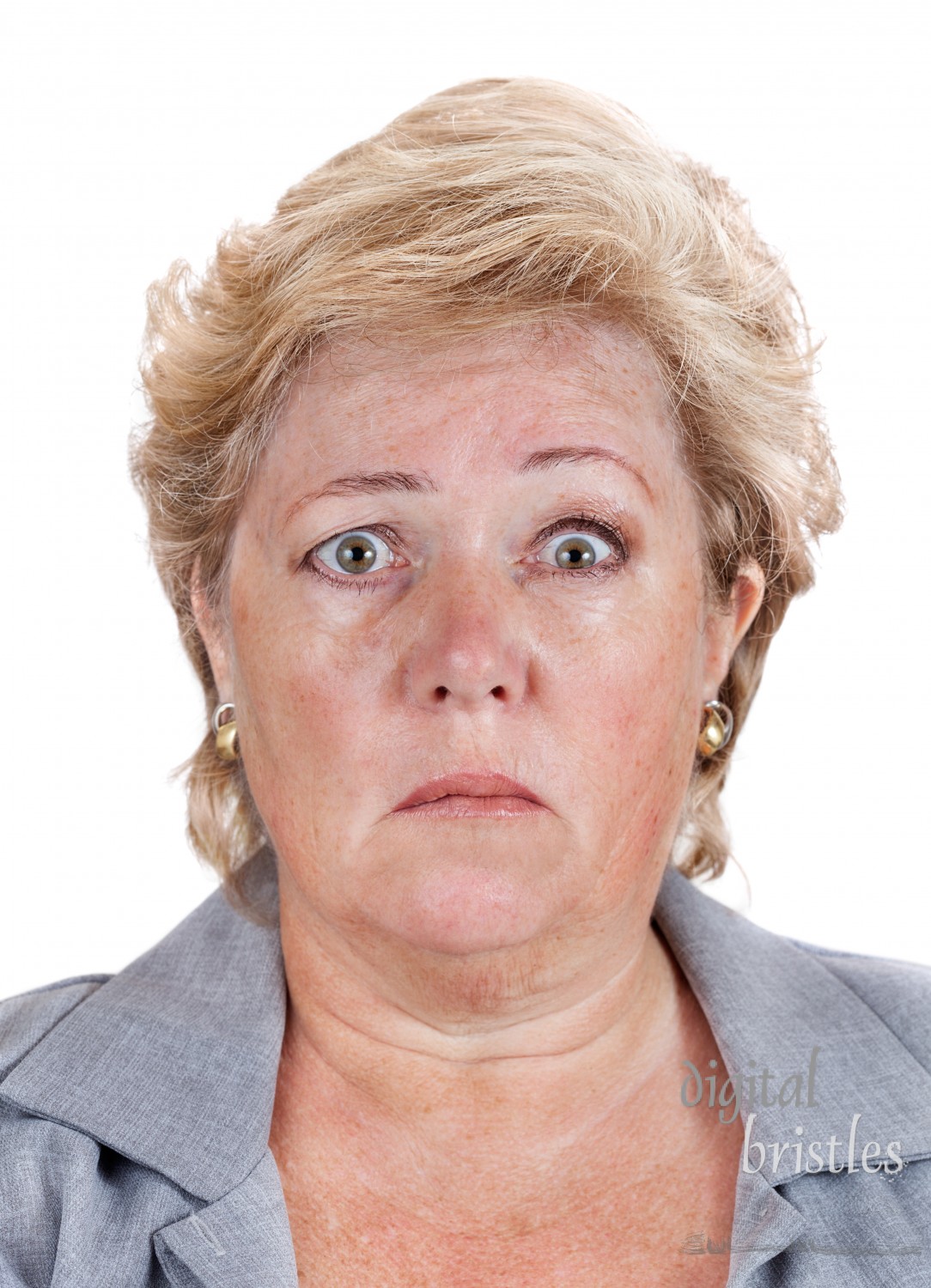 Mature woman with Bell's Palsy unable to move the right half of her face