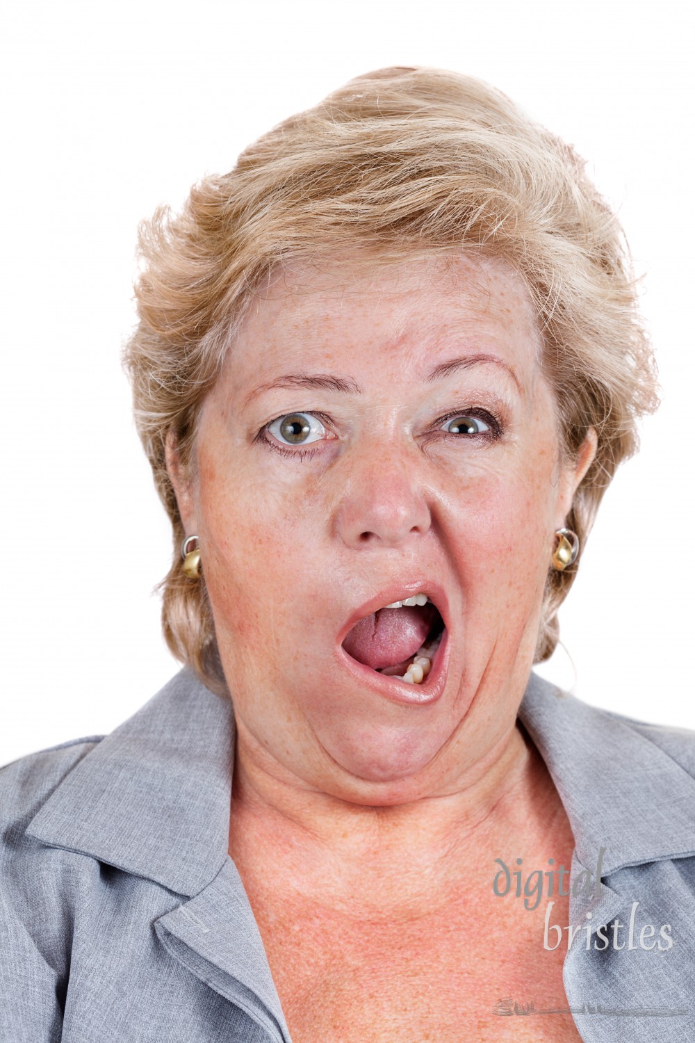 Mature woman with Bell's Palsy screaming with only half her face