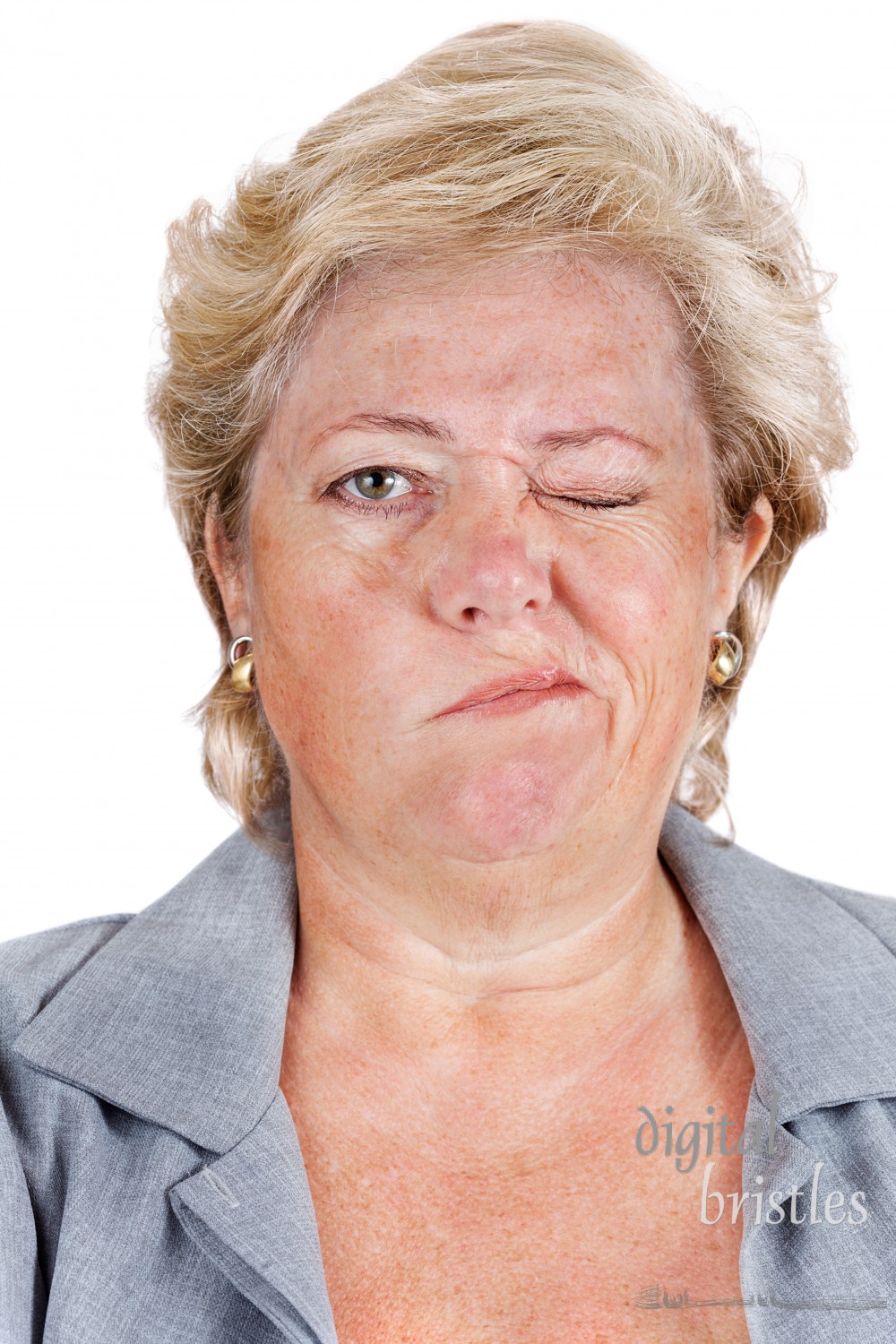 Mature woman with Bell's Palsy unable to scrunch up her right eye