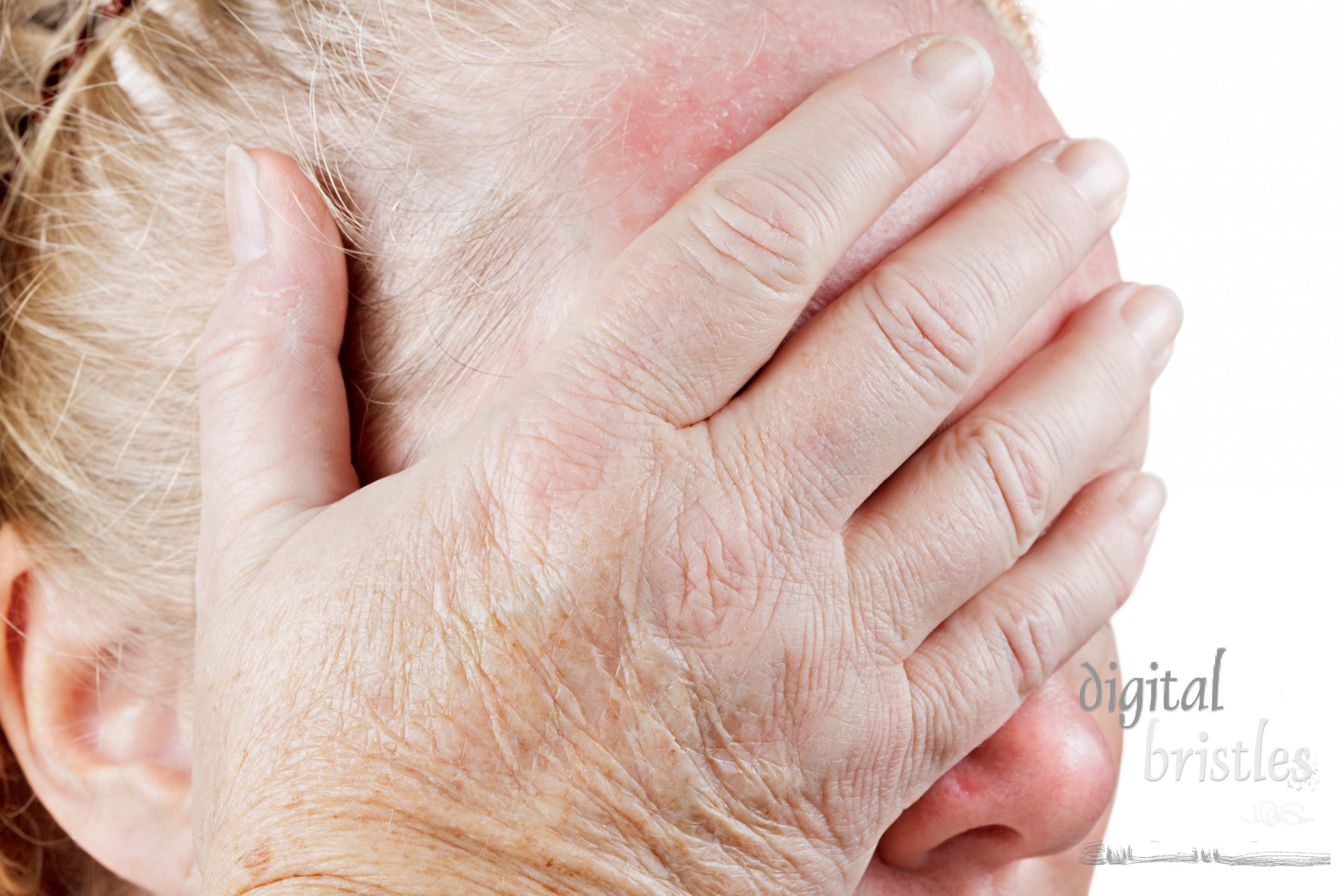 Mature woman holds her hand over her eye, showing wrinkled papery skin